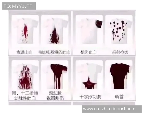 米利唐首次体检未能通过初步判断伤势情况较轻